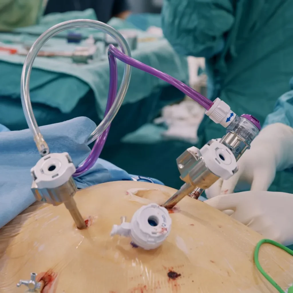 Laparoscopic & General Surgery