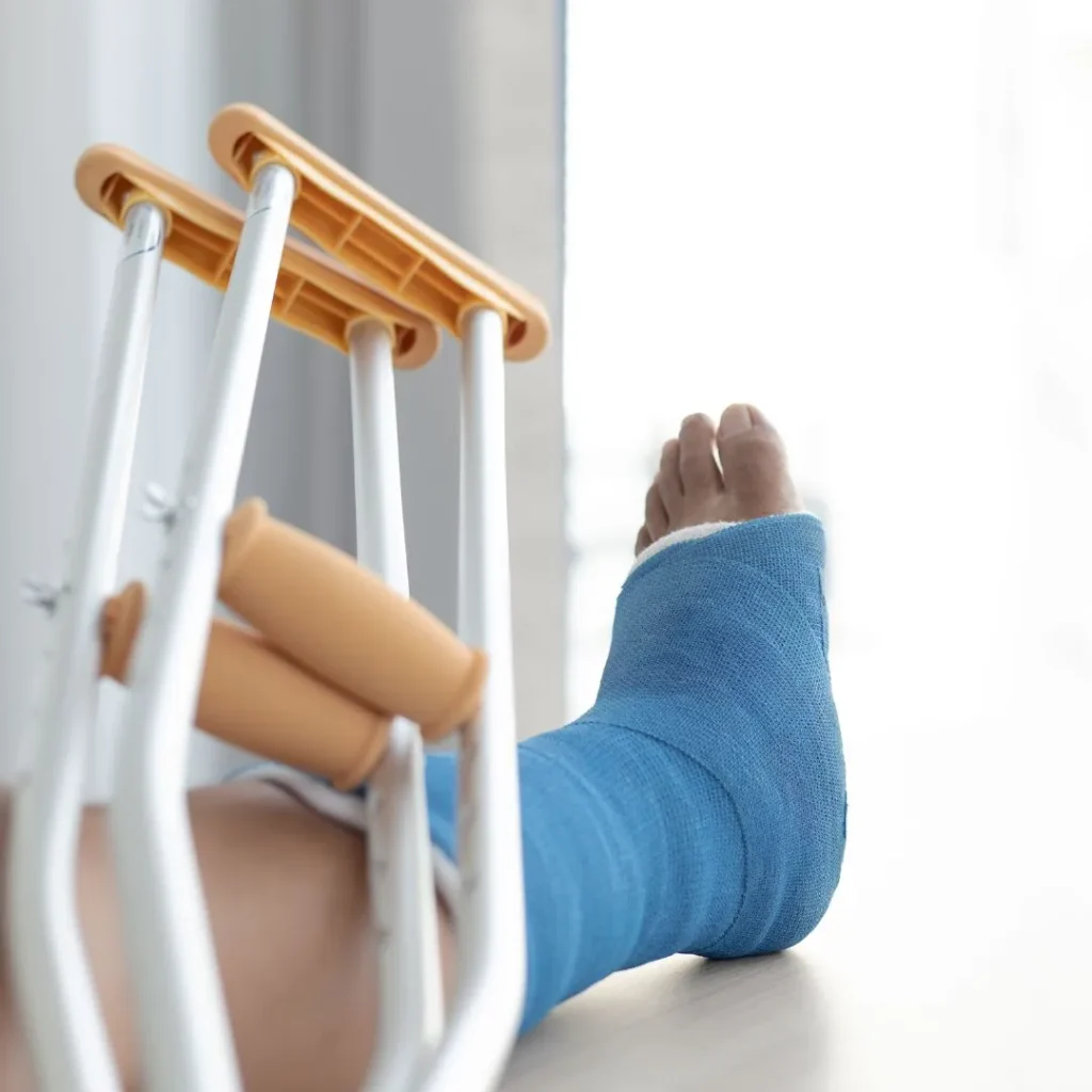 Fracture Management